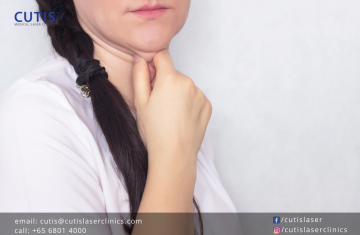 Will Your Double Chin Go Away If You Lose Weight?