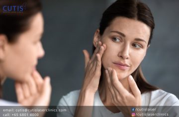 Surprise or Sudden Breakouts: Causes and Treatment Options