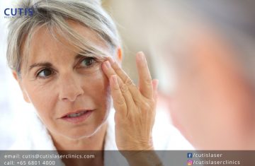 Non-Surgical Skin Tightening: Things You Should Know