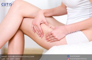 I’m Skinny: Why Do I Have Cellulite?