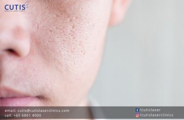 You Can’t Shrink Your Pores: What to do Instead