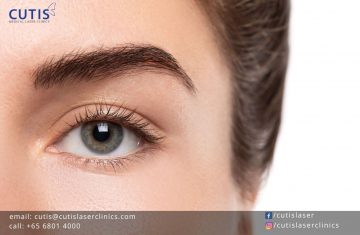 5 Non-Surgical Alternatives to Blepharoplasty or Eyelid Surgery