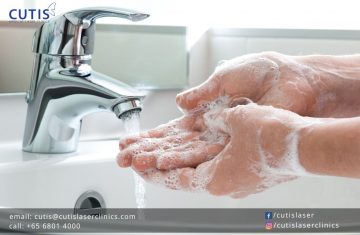 Over-washed Hands: How to Care for Them