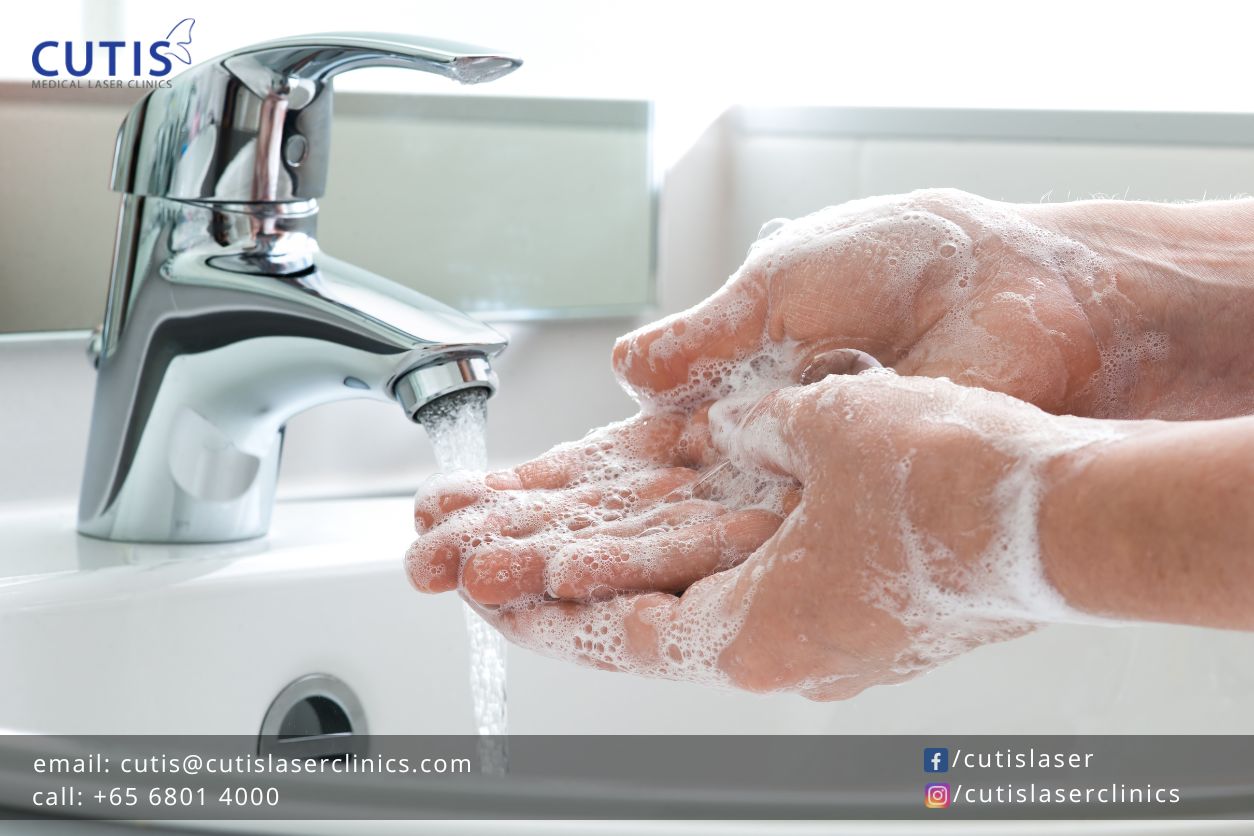 Over-washed Hands: How to Care for Them