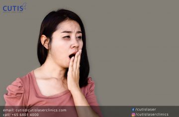 Hangover Face: What is It and How Can You Prevent it?