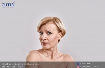 Infrared Skin Tightening: For Loose Skin, Jowls, & Wrinkles