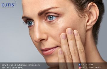 Radiofrequency Skin Tightening: How it Works & What to Expect