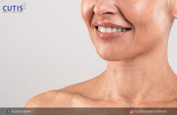 Say No to Neck Neglect: Aesthetic Treatments for Your Neck