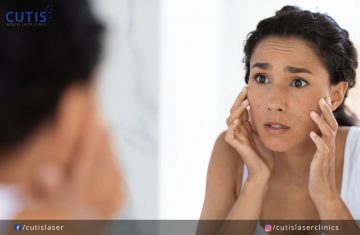 5 Daily Habits That Can Mess with Your Skin