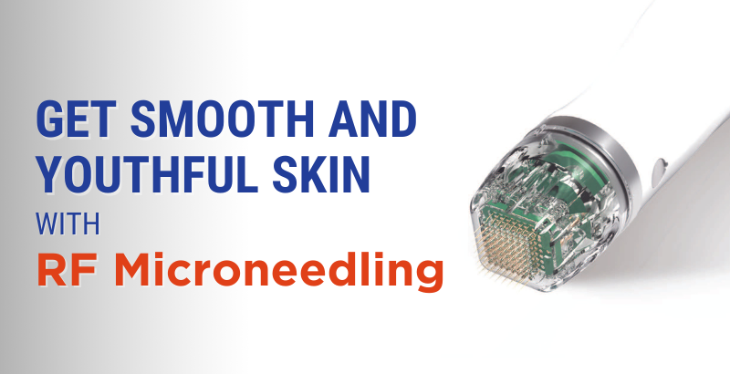 Get-smooth-and-youthful-skin-with-RF-Microneedling