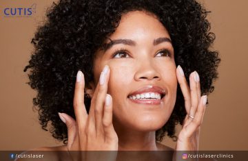 Aesthetic Treatments for Darker Skin: Important Things to Know