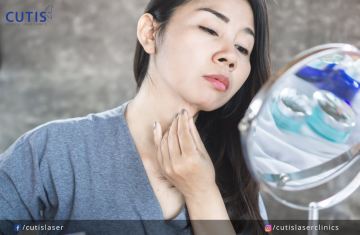 Debunking 5 Myths About Double Chin Removal