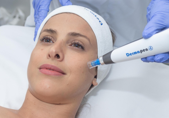 The Dermapen MG (Meso-Glide)
