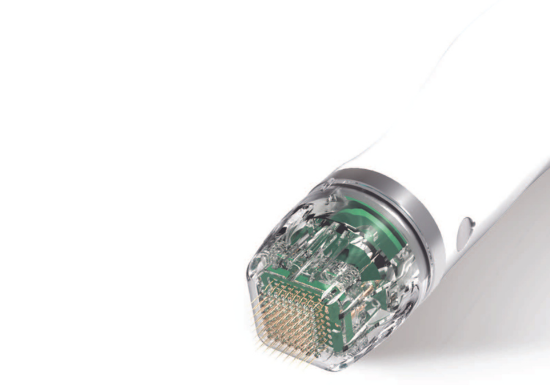 Treatment for spider veins and stretch marks