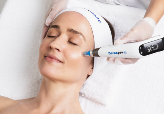 How does Dermapen 4 microneedling work?