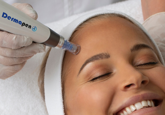 Medical Microneedling