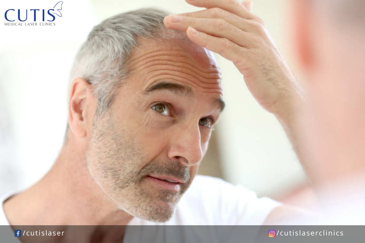 Why is Your Hair Thinning