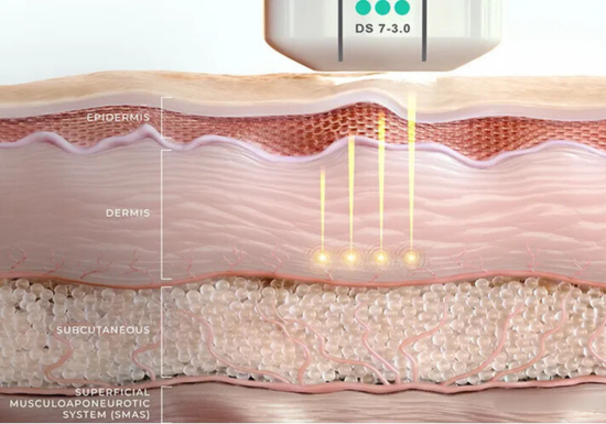 Collagen boosting treatment