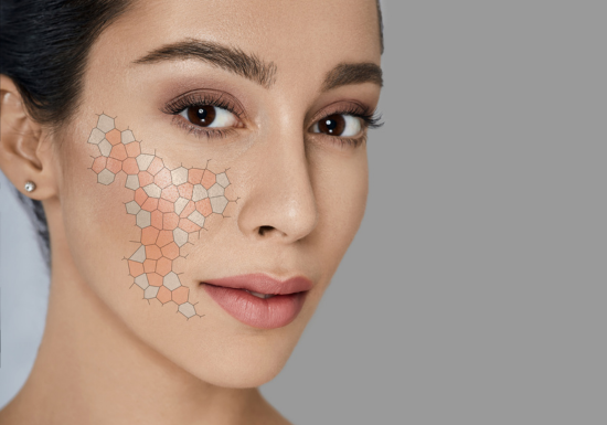 Skin Regeneration in Three Phases