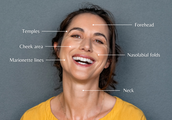 Fine lines and wrinkles treatment in singapore