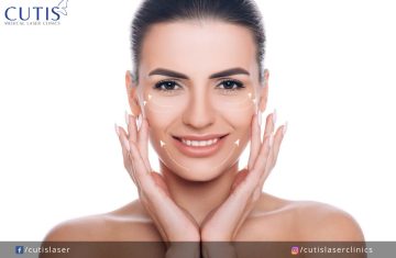 Ultherapy in Singapore: What to Expect Before, During, and After the Treatment