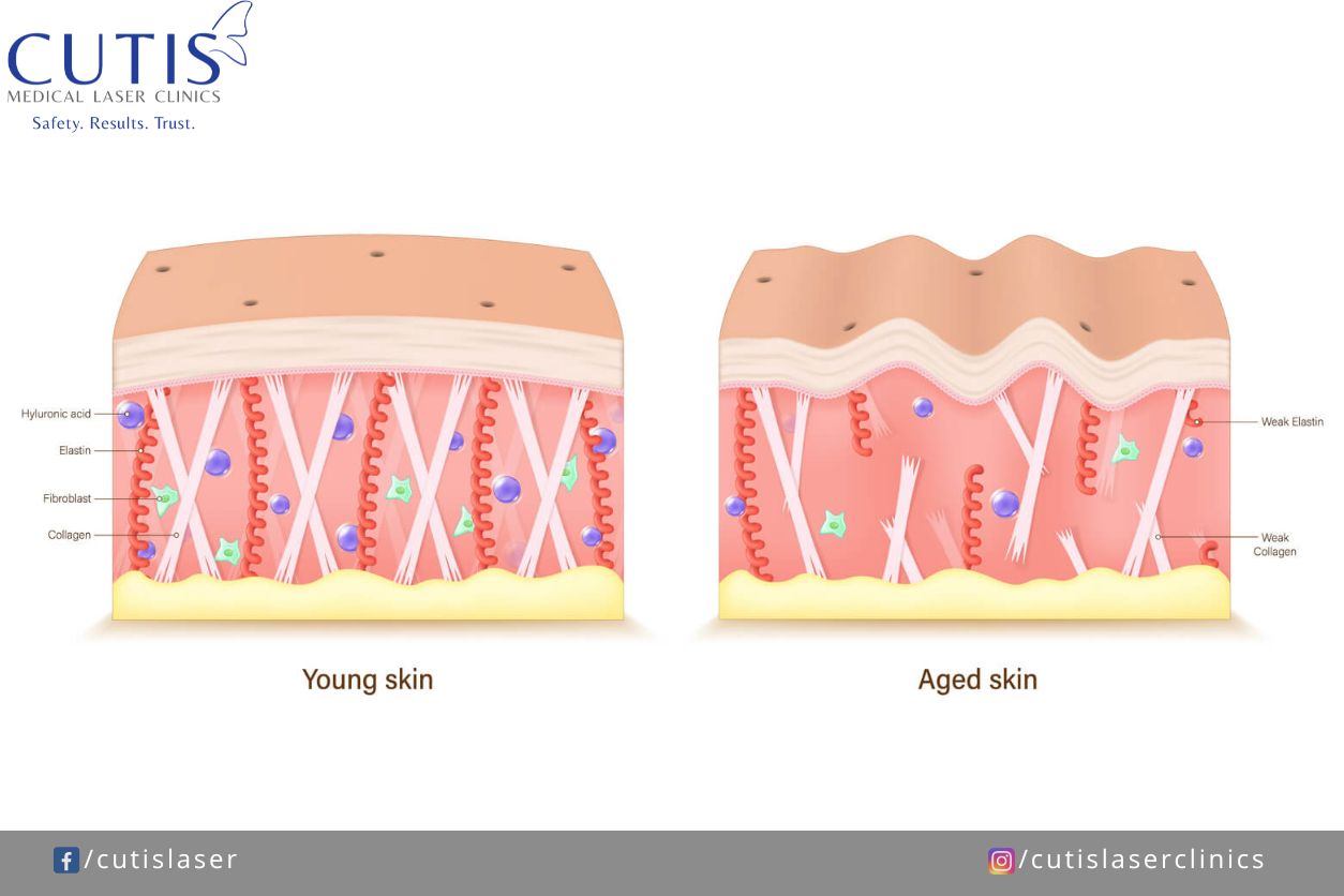 But first, what is collagen