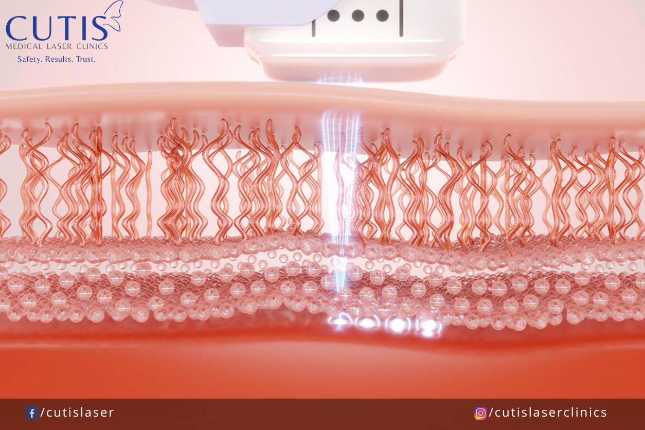 When should you start collagen banking