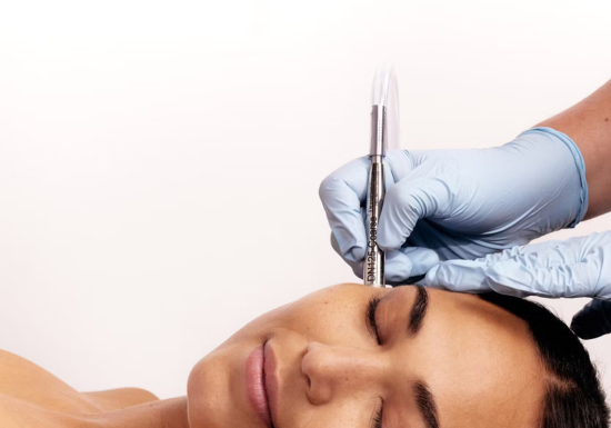 DiamondTome Microdermabrasion