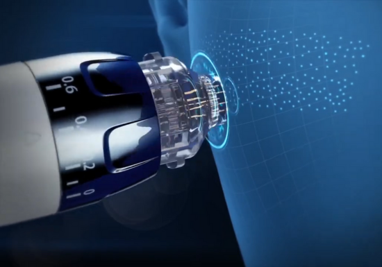 EPN Plus vs traditional microneedling