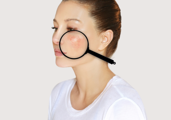 Dullness, Oily Skin, Enlarged Pores, Redness