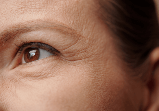 Imperium RF handpiece used for skin tightening and rejuvenation