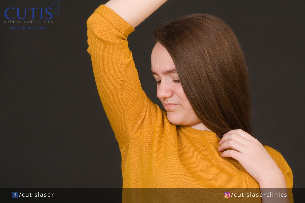 Excessive Sweating Here’s What You Should Know About Hyperhidrosis