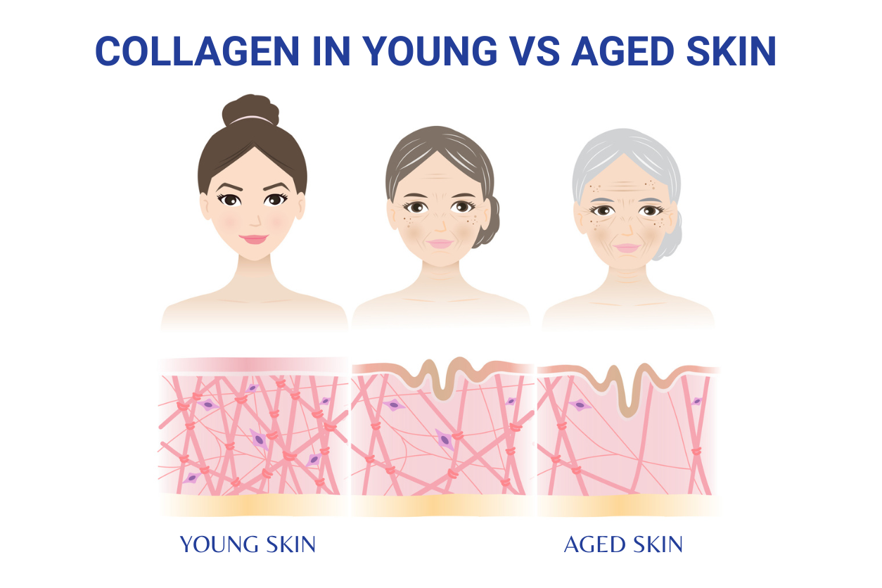 How to Keep Your Skin Young: The Role of Peptides, RF, Lasers, and SPF