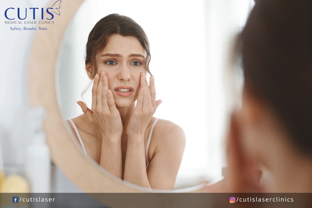 The Holiday Skin Survival Guide Stress, Sleep, Sugar, & Solutions- Stress The silent skin saboteur