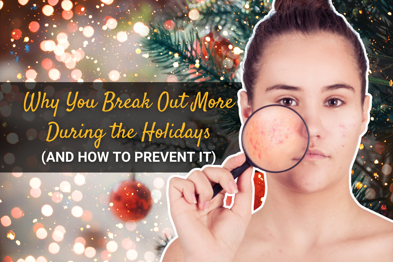 Why You Break Out More During the Holidays (And How to Prevent It)