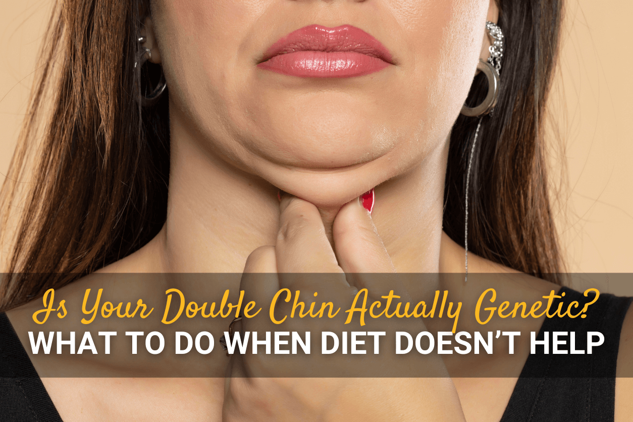 Is Your Double Chin Actually Genetic? What to Do When Diet Doesn’t Help