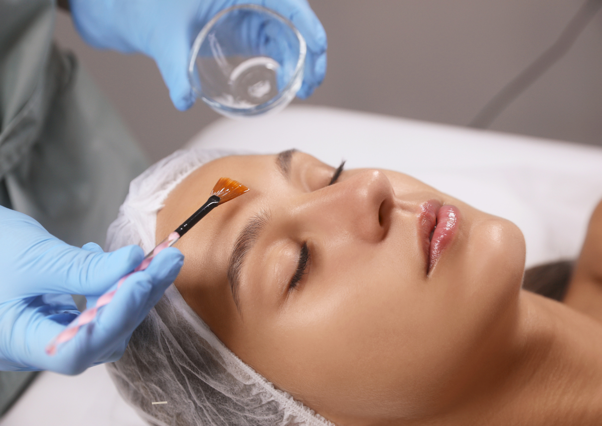 Chemical Peel Safety: How to Avoid PIH and Rebound Pigmentation