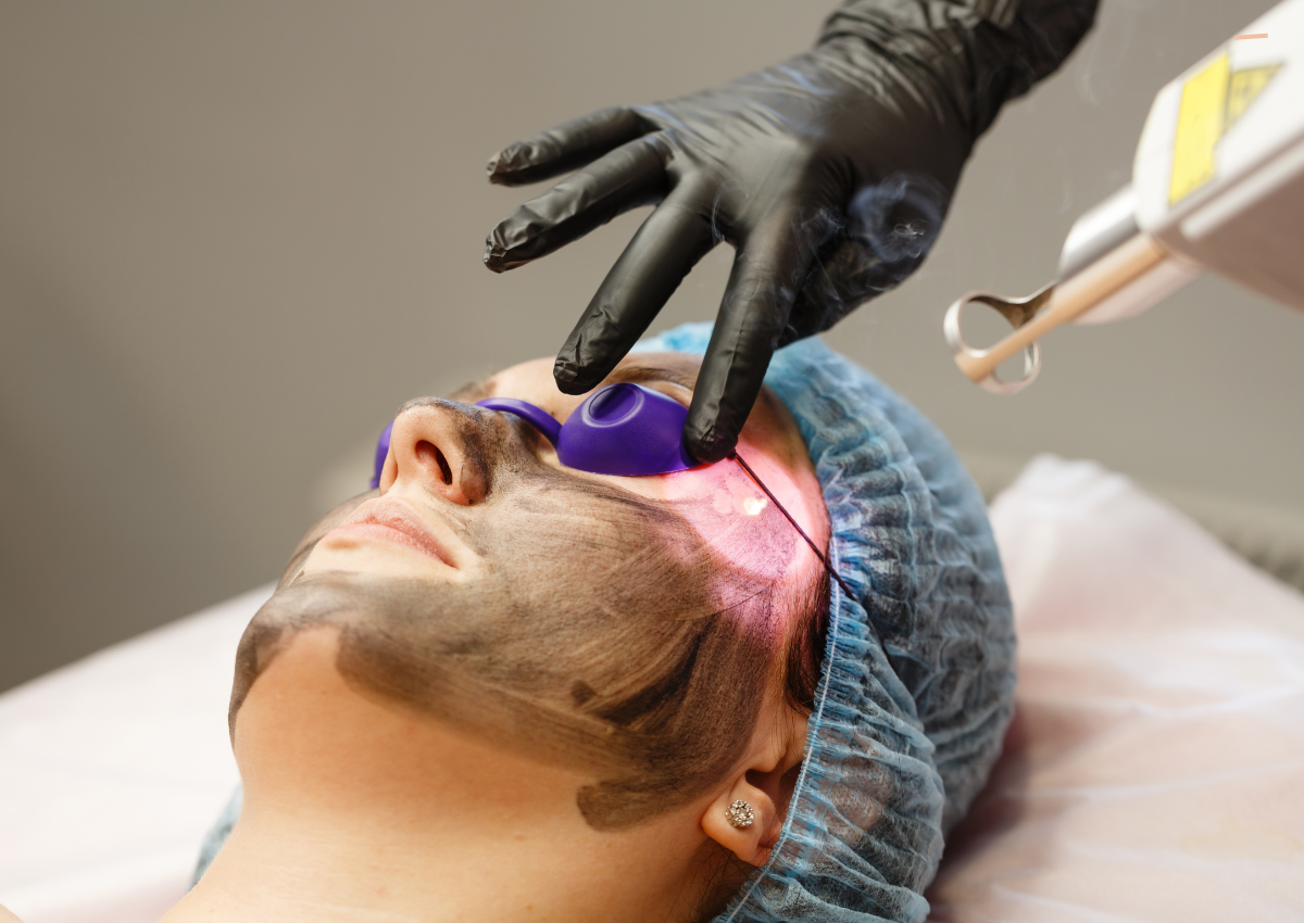 Is Laser Treatment Safe for Melasma and Darker Skin Tones?