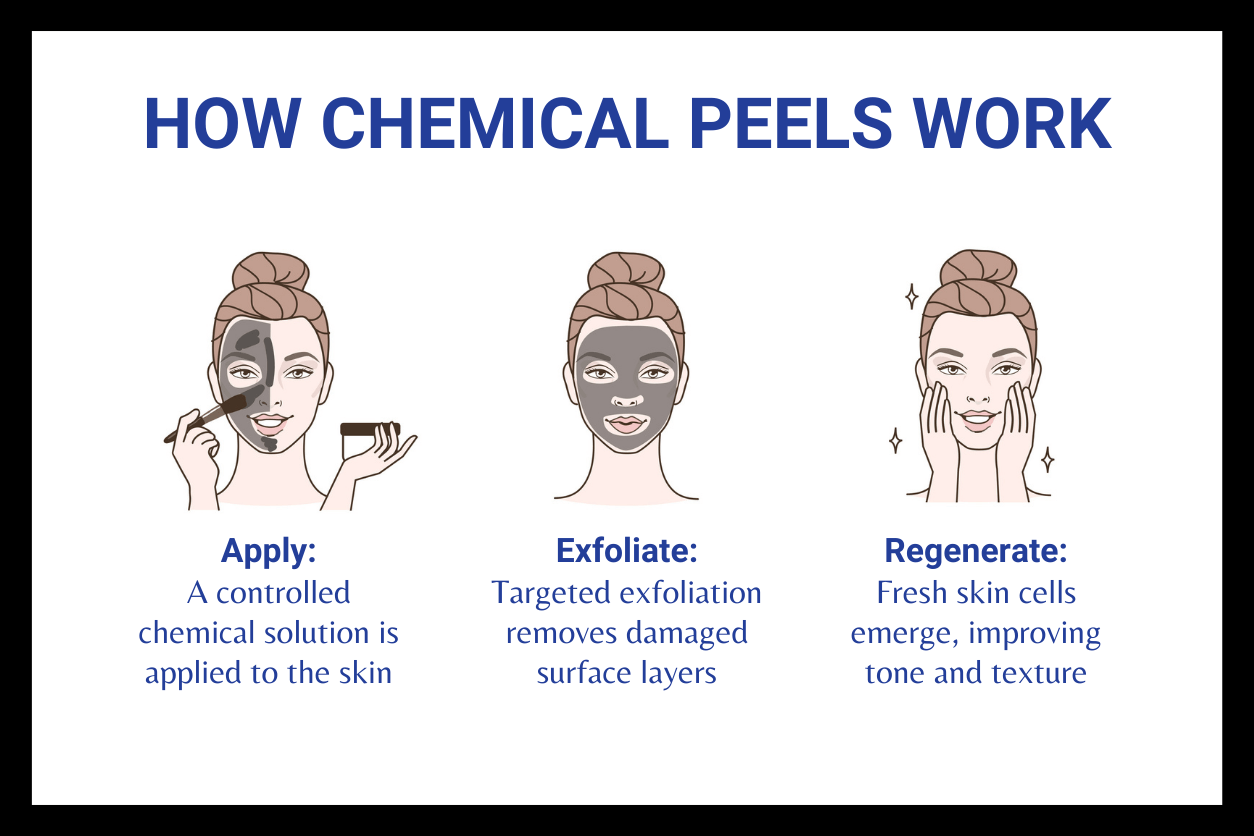 Medical-grade chemical peels