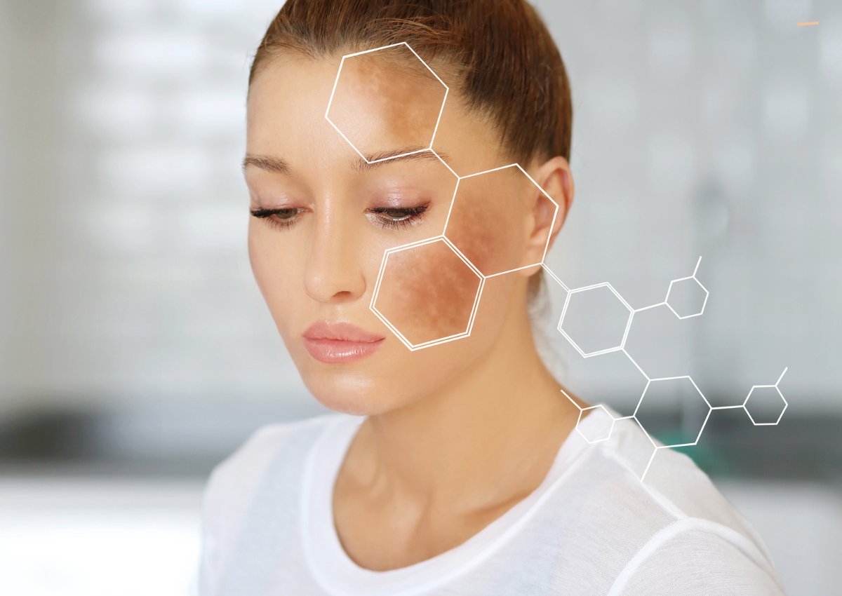How Pigment Forms: A Deep Dive into Melanin Activity & Skin Biology