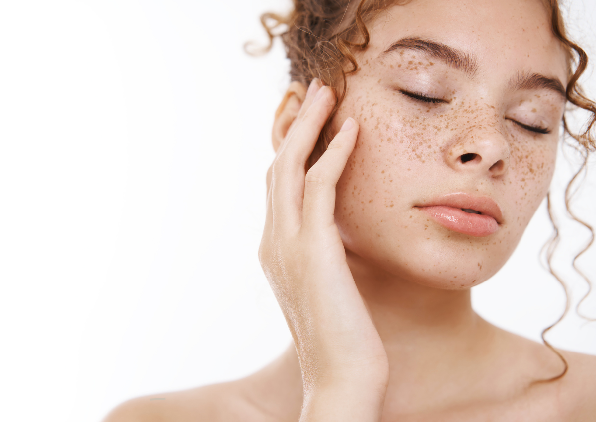 Melasma vs PIH vs Sunspots: How to Tell Your Pigment Type