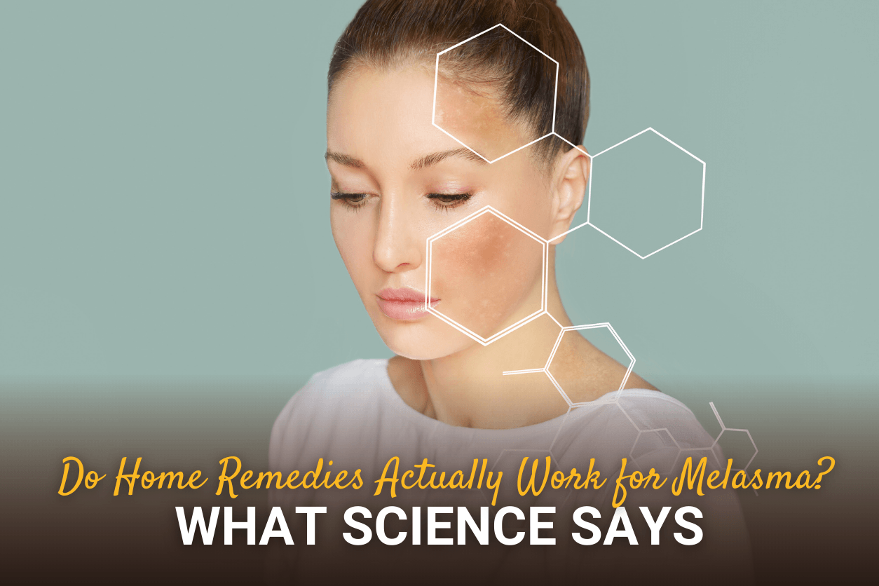 Do Home Remedies Actually Work for Melasma? What Science Says