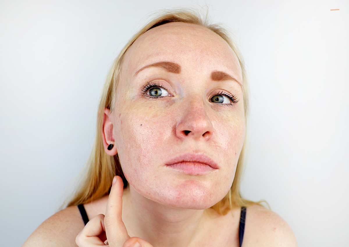 Pigment Control Plan: A Step-by-Step Skin Reset for February