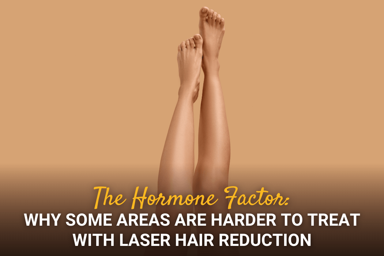 The Hormone Factor: Why Some Areas Are Harder to Treat with Laser Hair Reduction