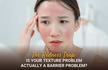 The Redness Trap: Is Your Texture Problem Actually a Barrier Problem?