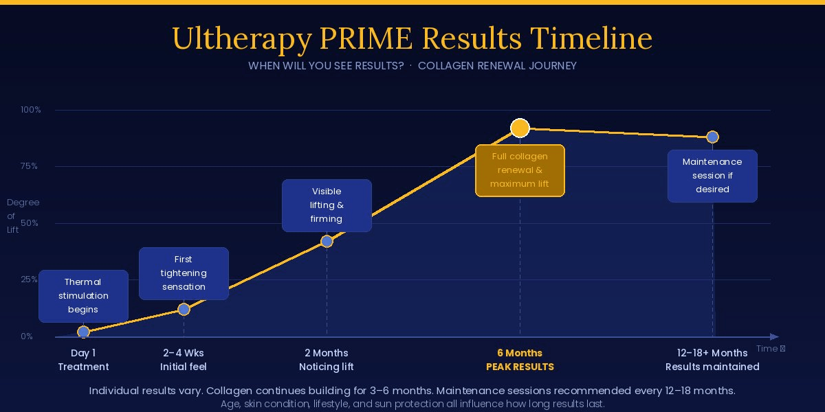 Results Timeline for Ultherapy Prime and How Long They Last