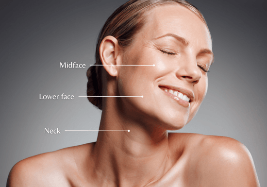 Hybrid Filler Treatment areas