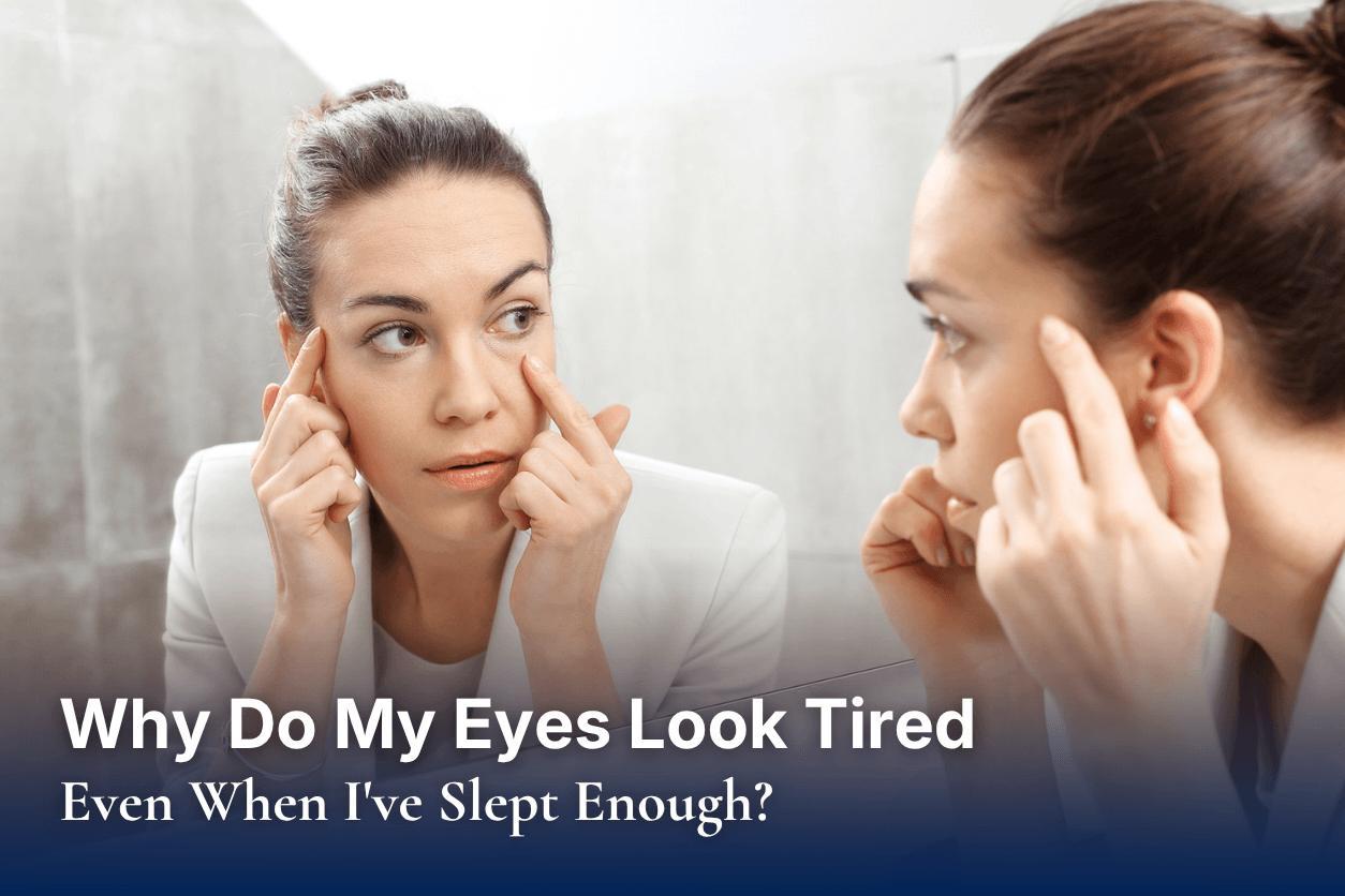 Why Do My Eyes Look Tired Even When I've Slept Enough?